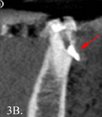  transaxial image