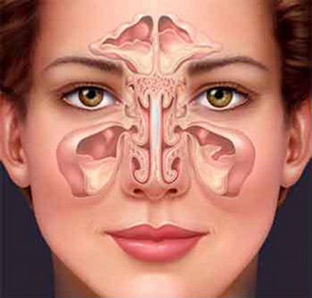 Maxillary sinuses